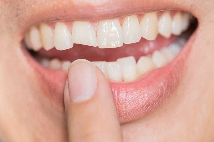 Who Repairs Teeth and Oral Issues?