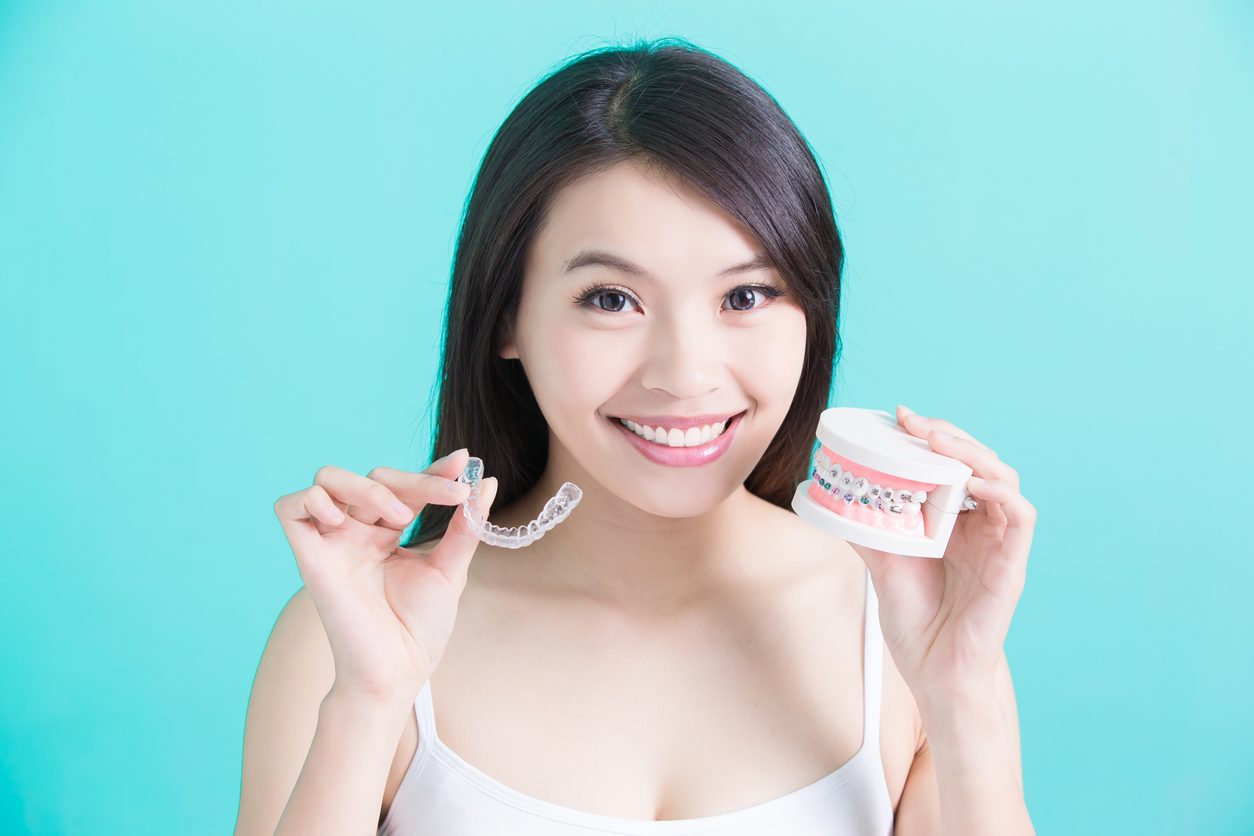 Important Things You Should Consider Before Getting Invisalign